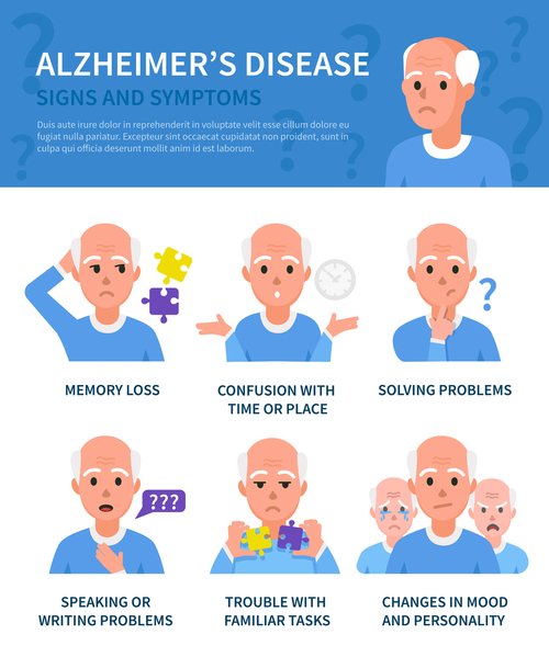 Alzheimers Disease Signs at Different Stages